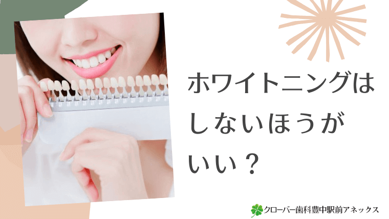 ホワイトニングはしないほうがいい？